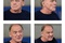 bruno-ganz-acteur-jpg