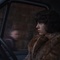 under-the-skin-png - Under the skin 