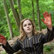 emma watson mains ensanglant  es