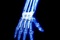 x men origins - X-Men Origins : Wolverine
