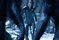 kate beckinsale face a deux lycans